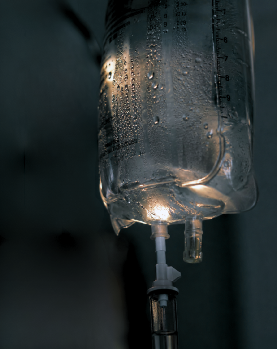 Close-up of a translucent IV fluid bag with condensation droplets, connected to a drip chamber and tubing against a dark background.
