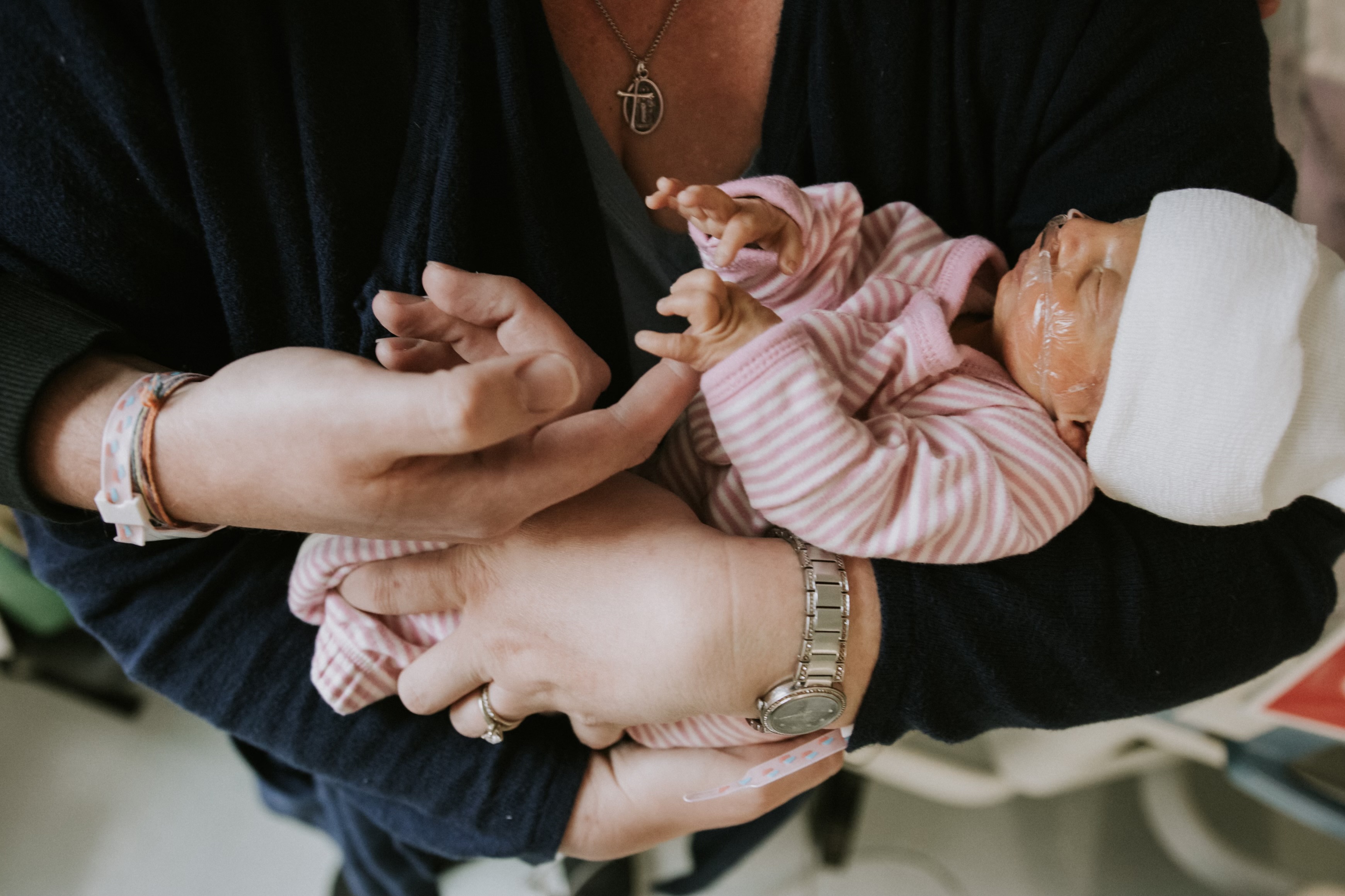 Newborn baby wearing a white hat and cleared adhesive on face, dressed in pink striped outfit, cradled in adult's arms.