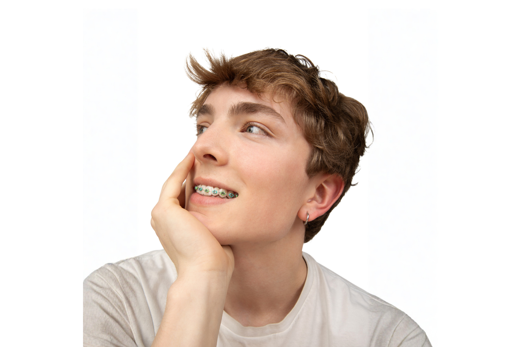 LightForce Orthodontics Adds Metal Option to Its Generative Braces System