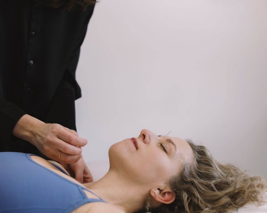 Acupuncture
