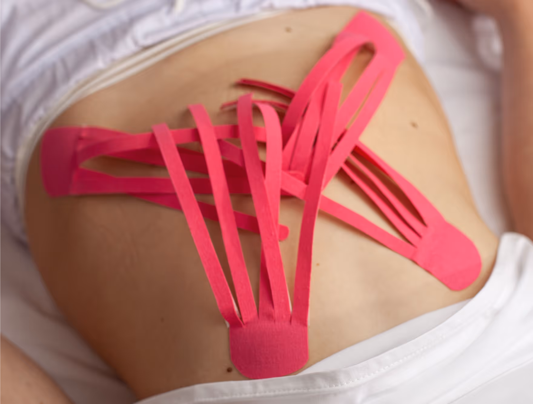 Кінезіологічне тейпування попереку