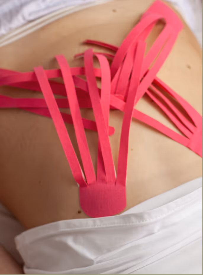 Кінезіологічне тейпування попереку