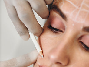 Botox treatment at SkinHealth in Coral Gables