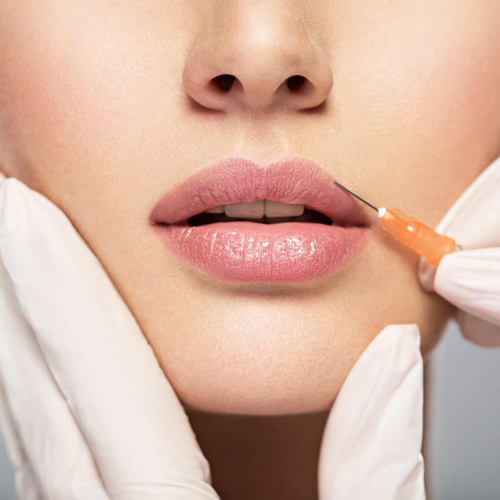 Lips treatment at SkinHealth in Coral Gables