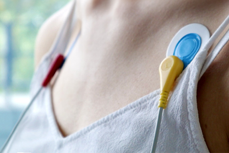 Elektroden eines Langzeit-EKG auf dem Brustkorb einer Patientin