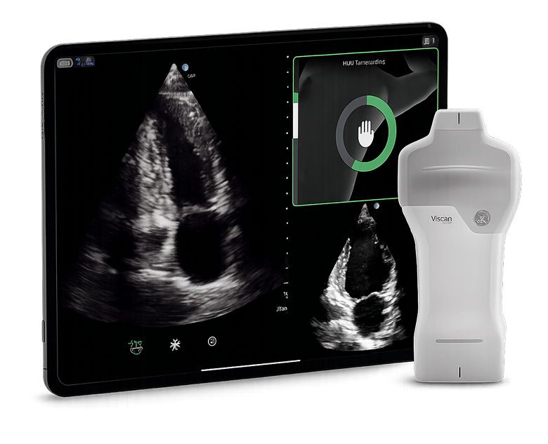 Image of equipment used for AI-Guided Cardiac Ultrasound