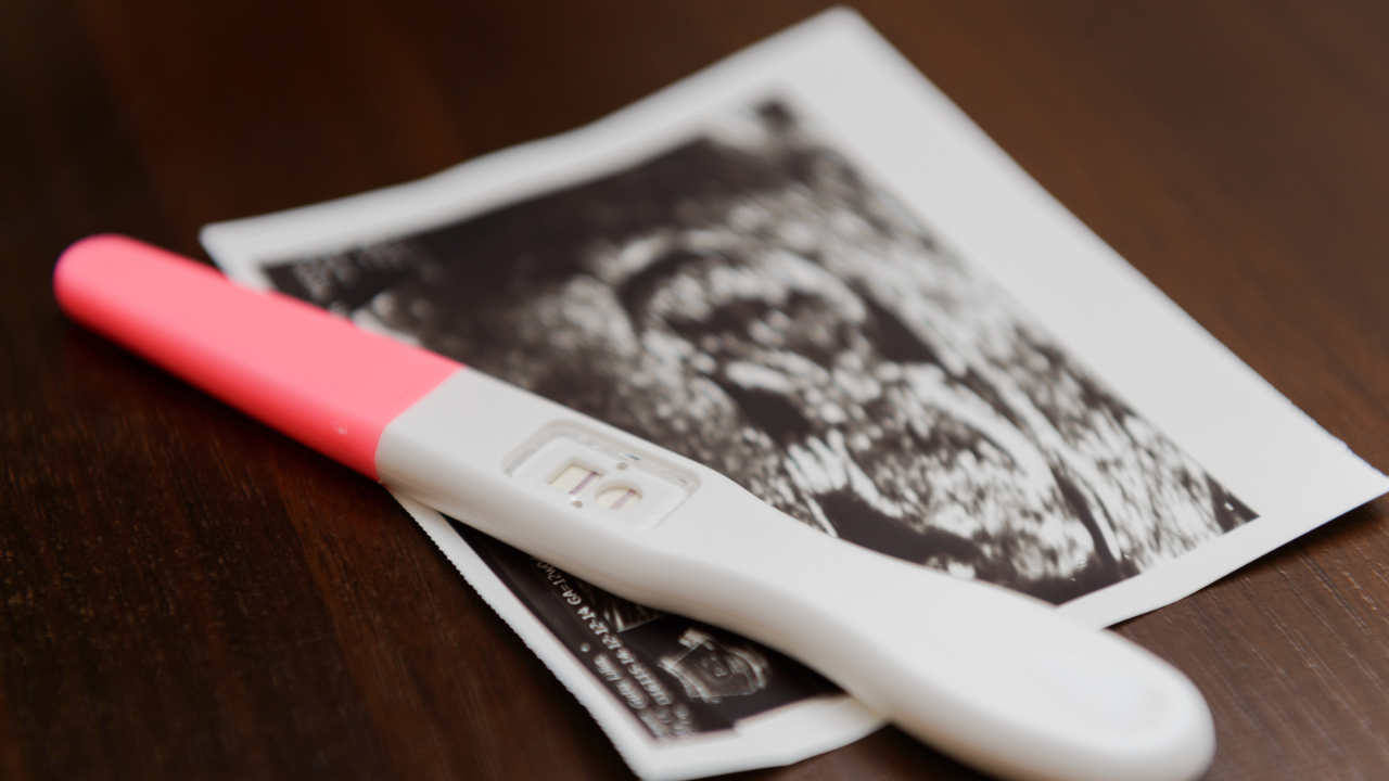 A pregnancy test resting on an ultrasound scan, illustrating concerns about how hydroxyurea treatment for sickle cell disease may affect fertility, pregnancy and family planning.
