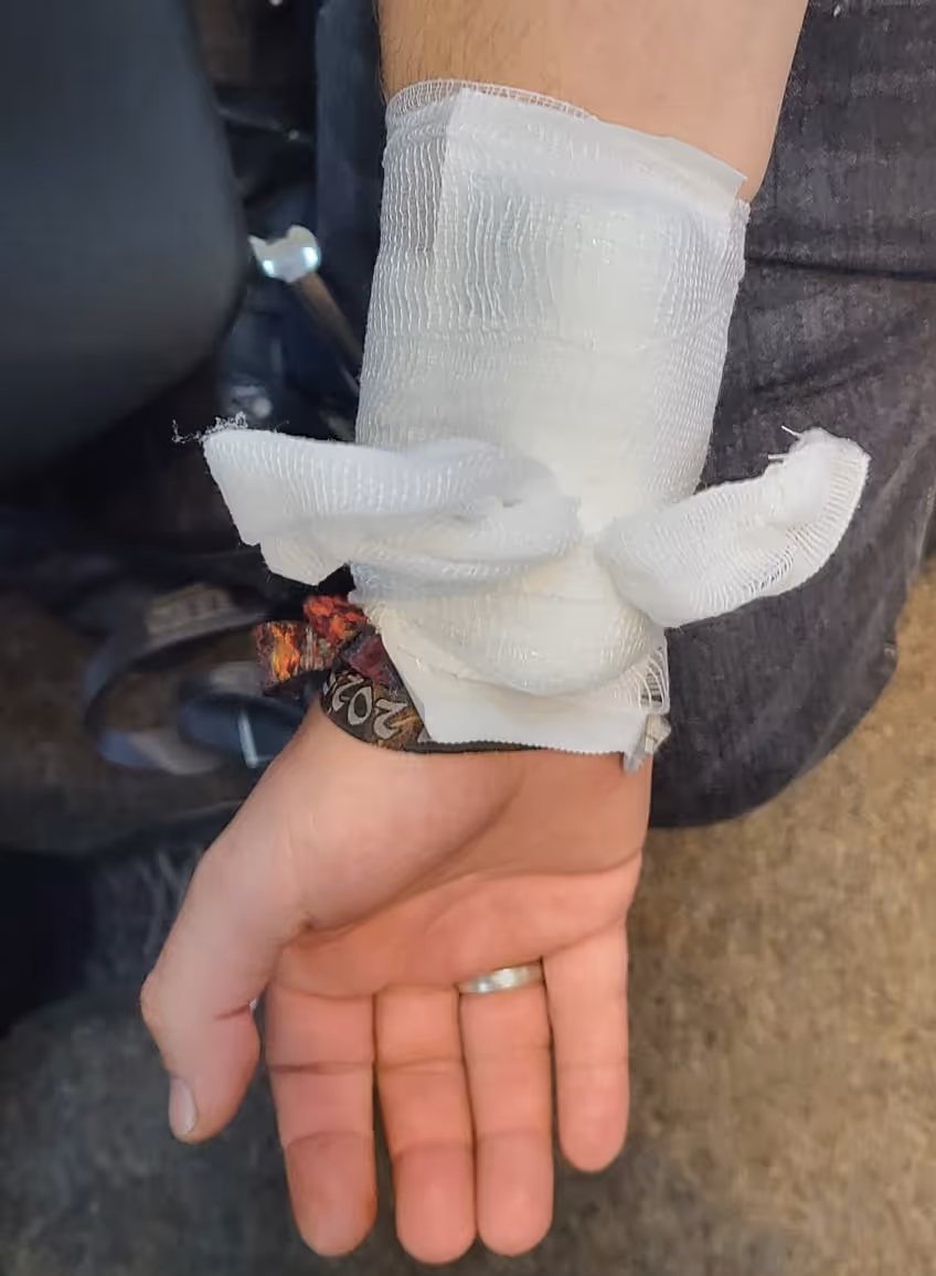 Hand mit einem weißen Verband um das Handgelenk.