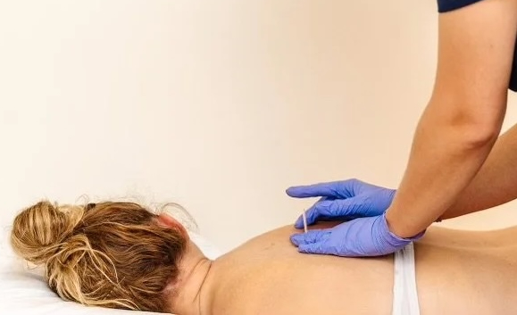 medical provider performing dry needling treatment on a woman