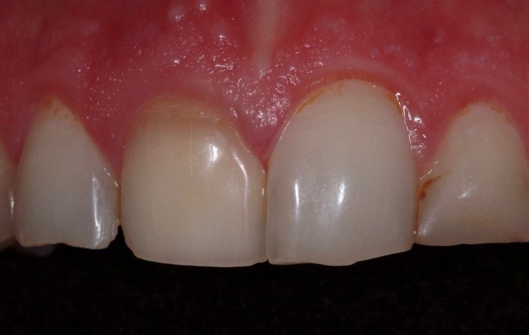 Pre-Op Clinical View