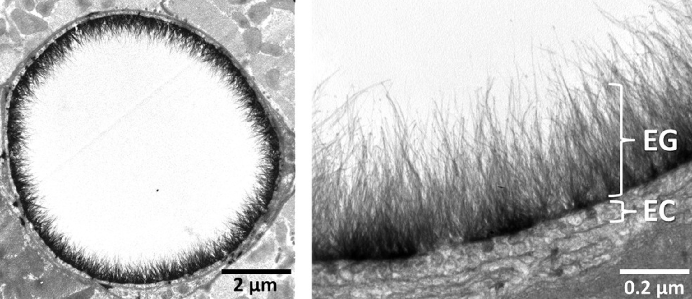 Electron micrographs of the endothelial glycocalyx