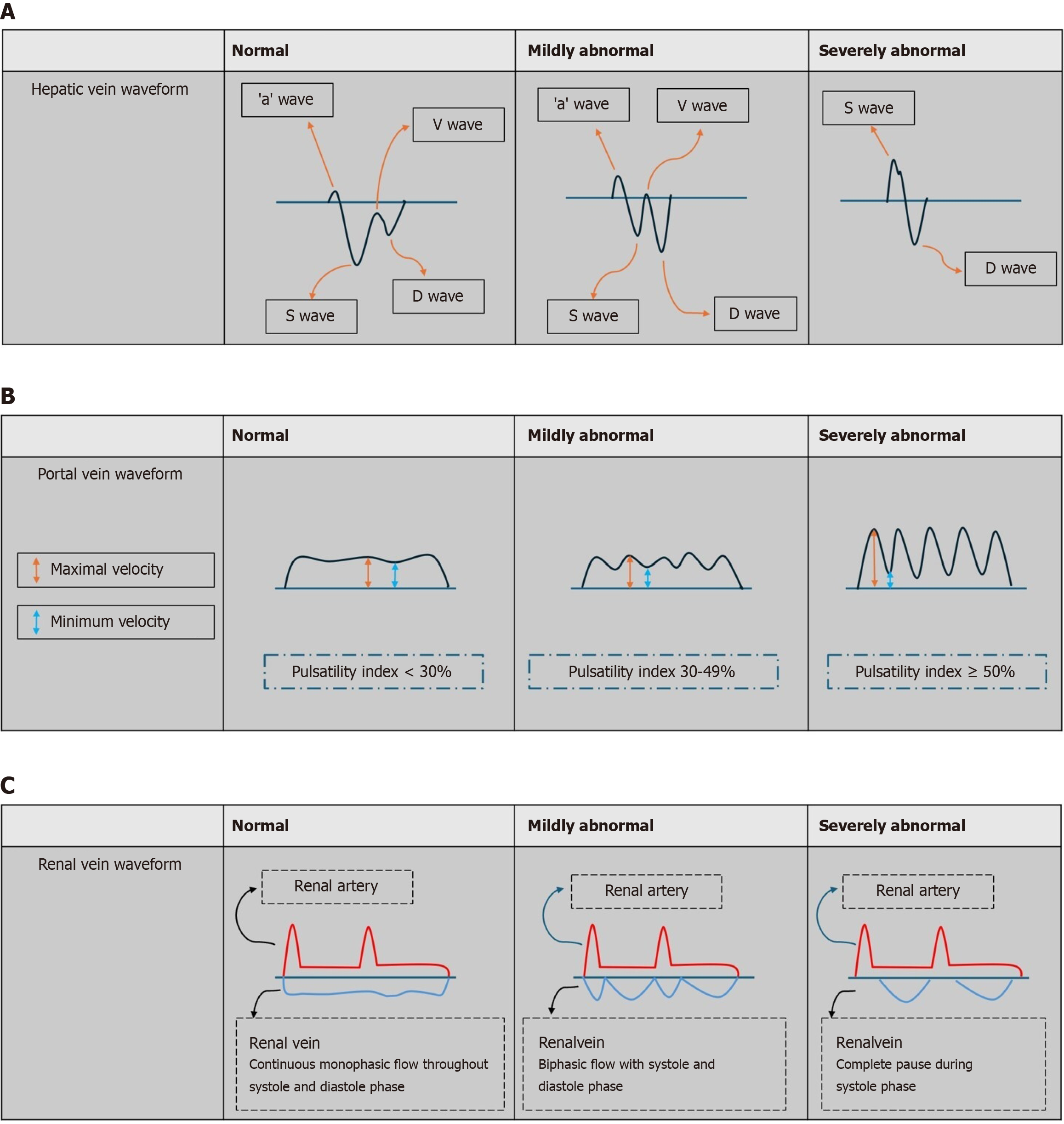 Figure 10 Graphic representation of the interpretation of the venous excess ultrasound grading system