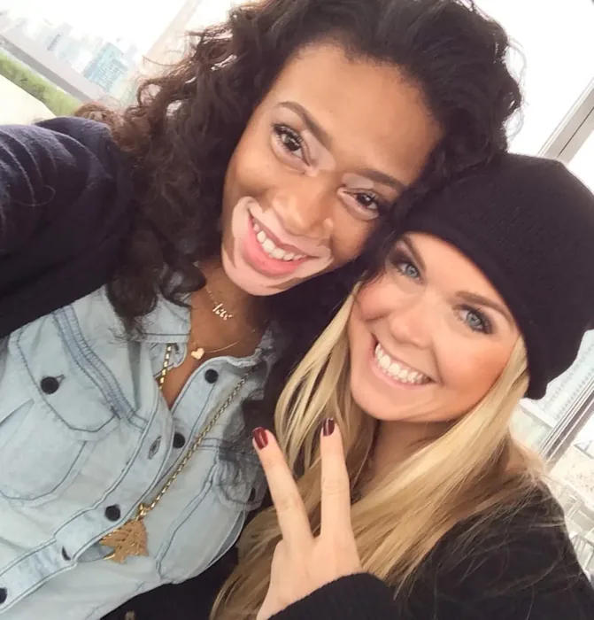 Model trotz Hautkrankheit Vitiligo - Chantelle Brown-Young!