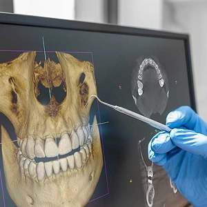 Dr. Monempour CBCT 3D Imaging