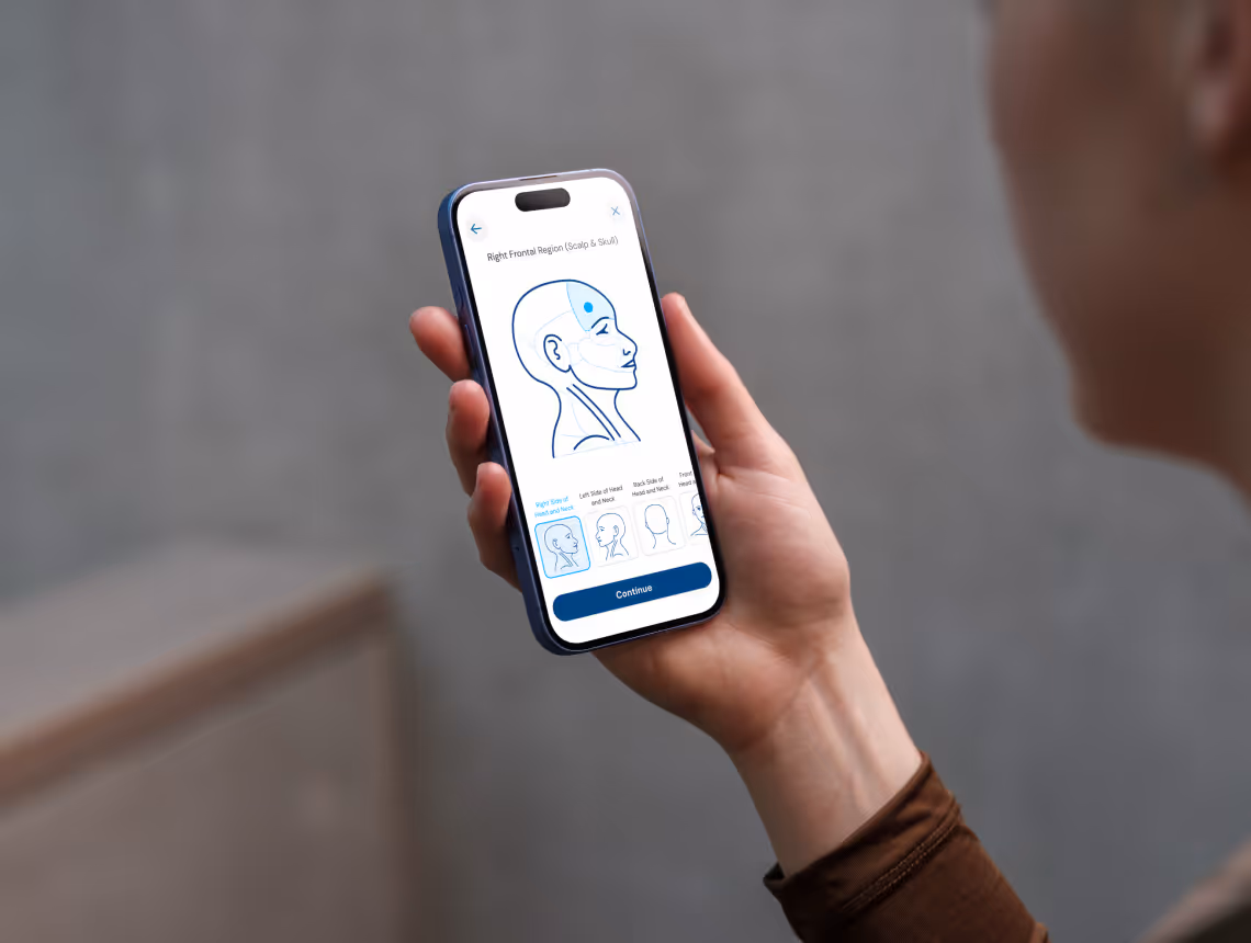 Person holding smartphone showing an app with an anatomical head diagram to capture wound location.