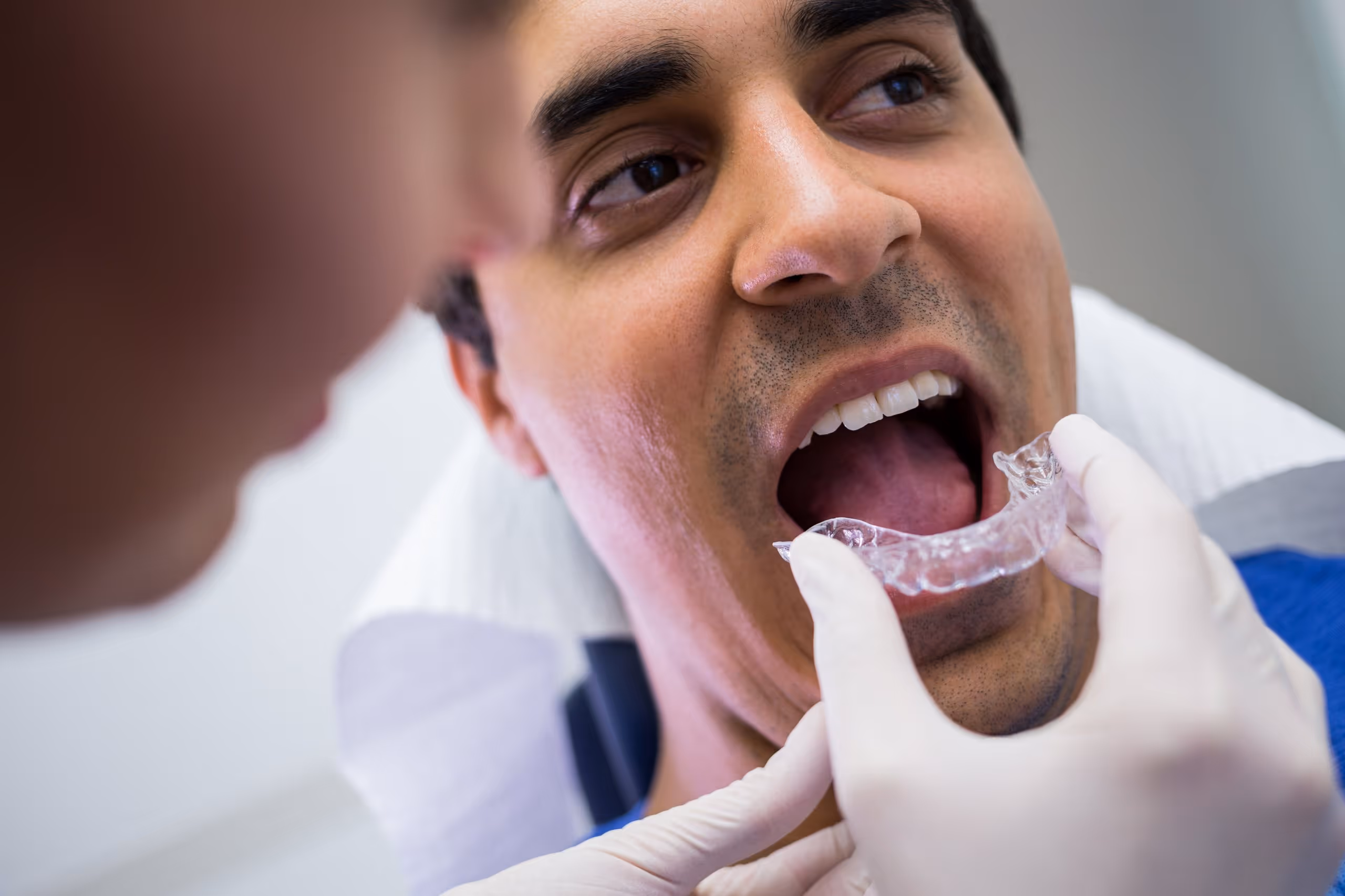 Dentist fitting a clear dental mouthguard into a male patient's open mouth.
