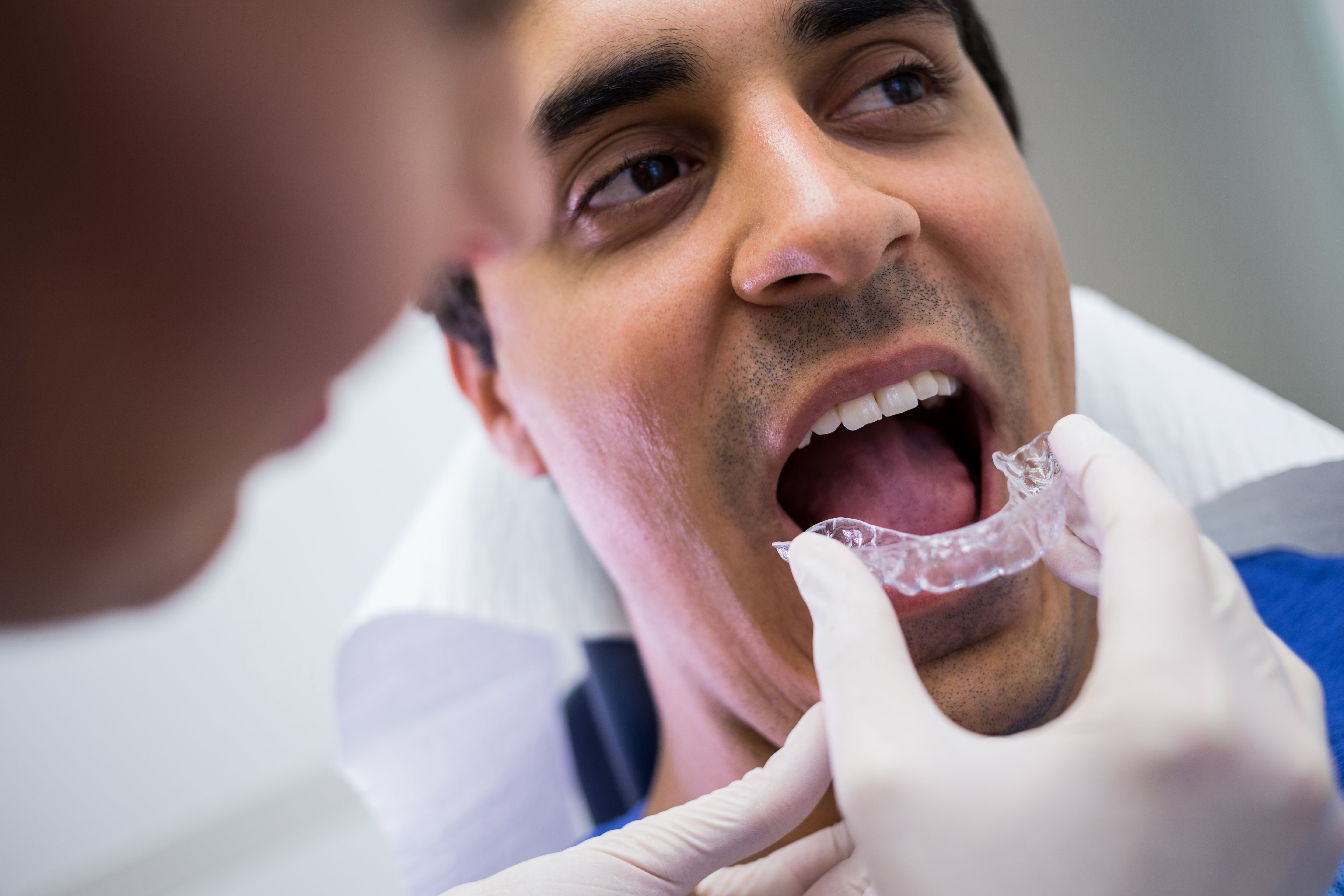 Dentist wearing gloves fitting a clear dental aligner into a male patient's open mouth.