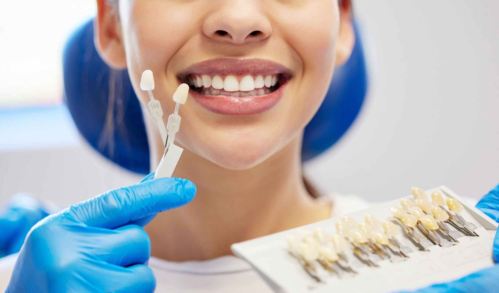 Getting Veneers in Clifton, NJ: Transform Your Smile with Confidence