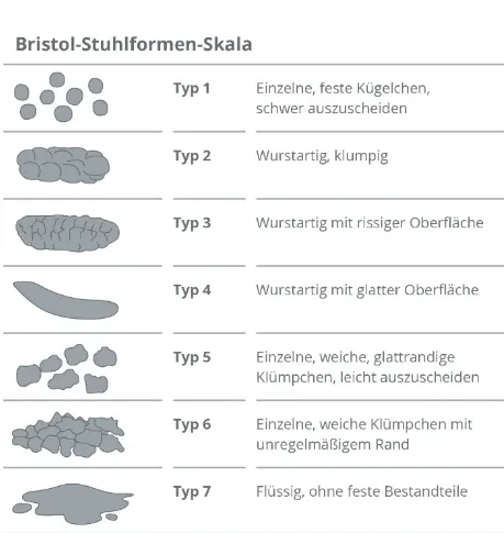 Bristol-Stuhlformen-Skala mit sieben Typen von Stuhlformen, von einzelnen festen Klümpchen bis flüssig ohne feste Bestandteile, beschrieben jeweils mit typischen Eigenschaften.