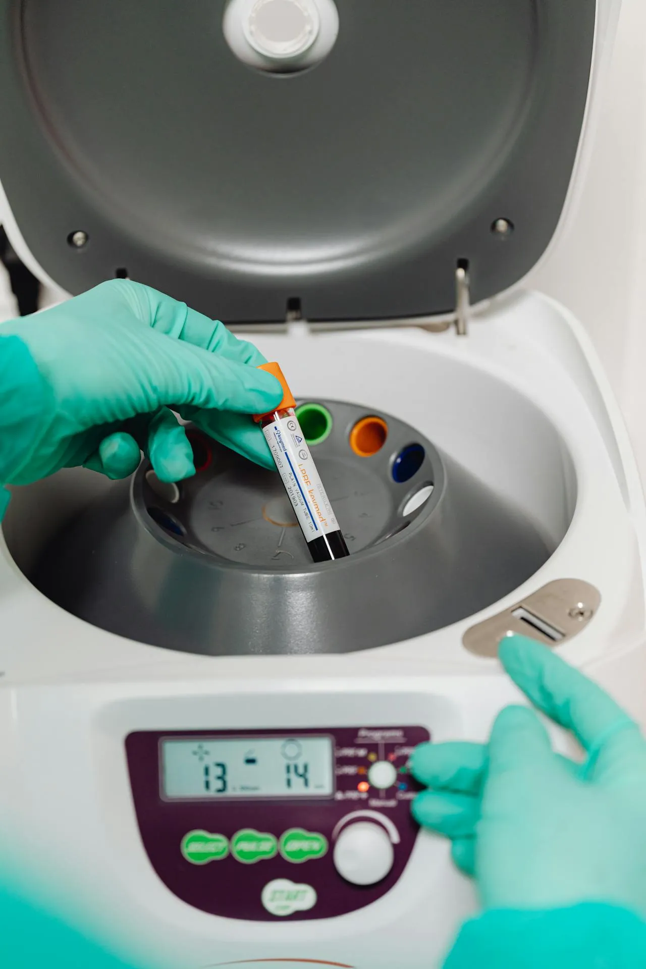 Gloved hands placing a blood sample vial into a centrifuge for PRP processing