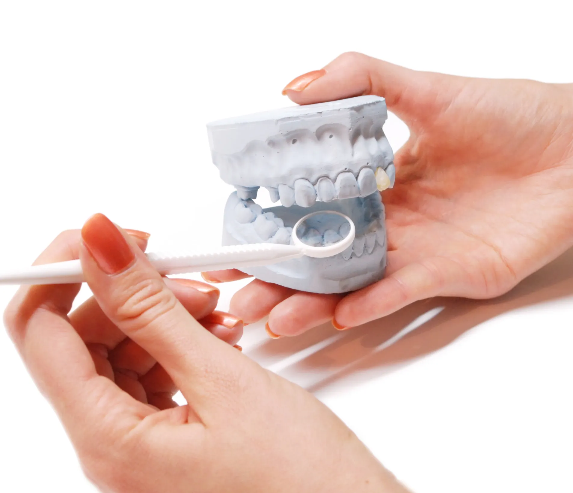 Hands holding a dental mold with a dental mirror examining the teeth.