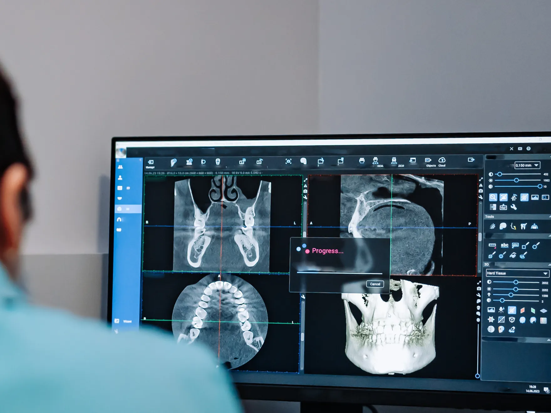 Computer screen displaying 3D dental and skull scans with progress bar, viewed by a person.