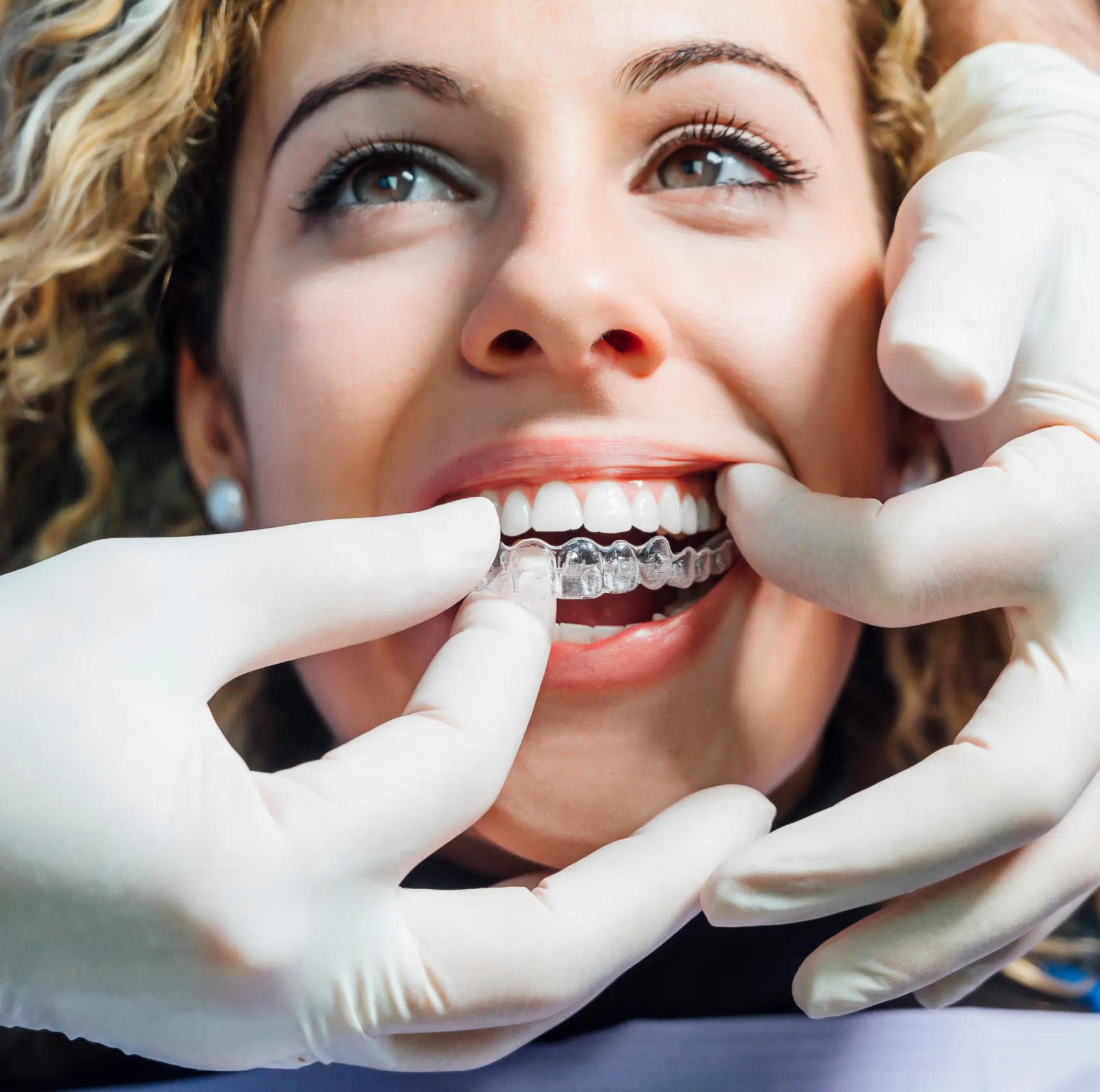 Close-up of a woman smiling while a gloved dental professional fits a clear Invisalign aligner on her upper teeth.