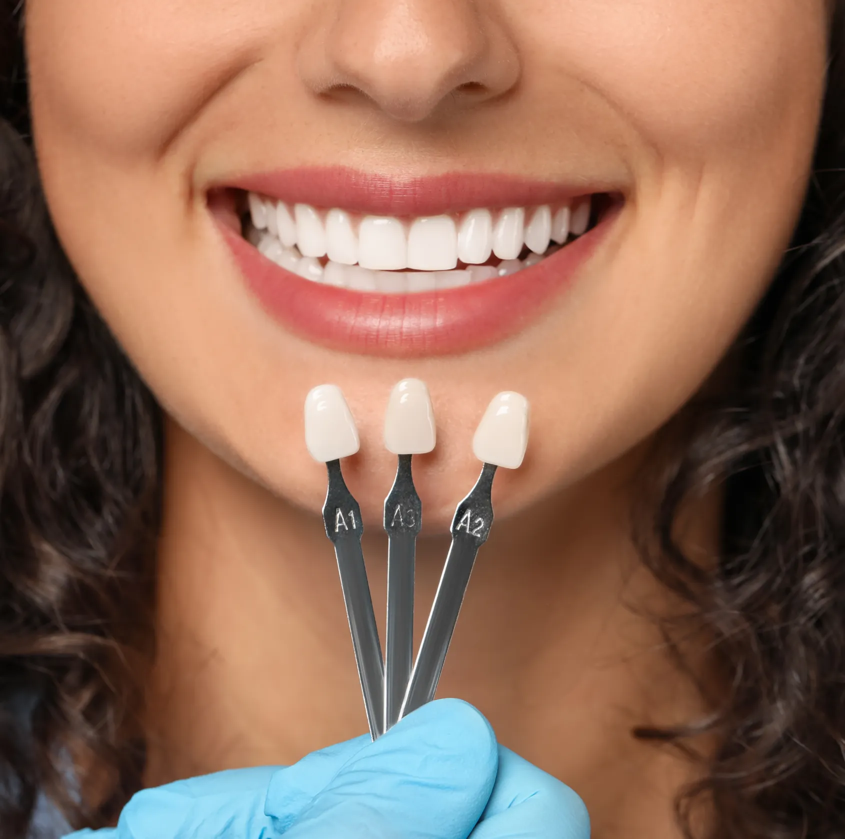 Close-up of a smiling woman with dental veneers shade guide A1, A3, and A2 held near her teeth by a gloved hand.