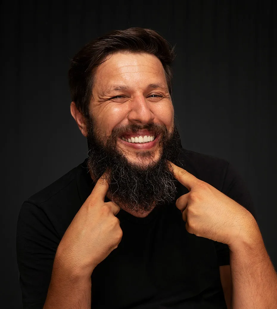 young man smiling and point at new teeth.