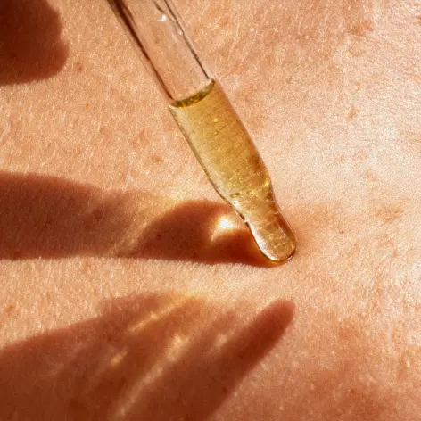 Pulizia atraumatica del viso — trattamento per pelle con comedoni ed eccesso di sebo nello studio di dermoestetica ARCHIVIA, Perugia