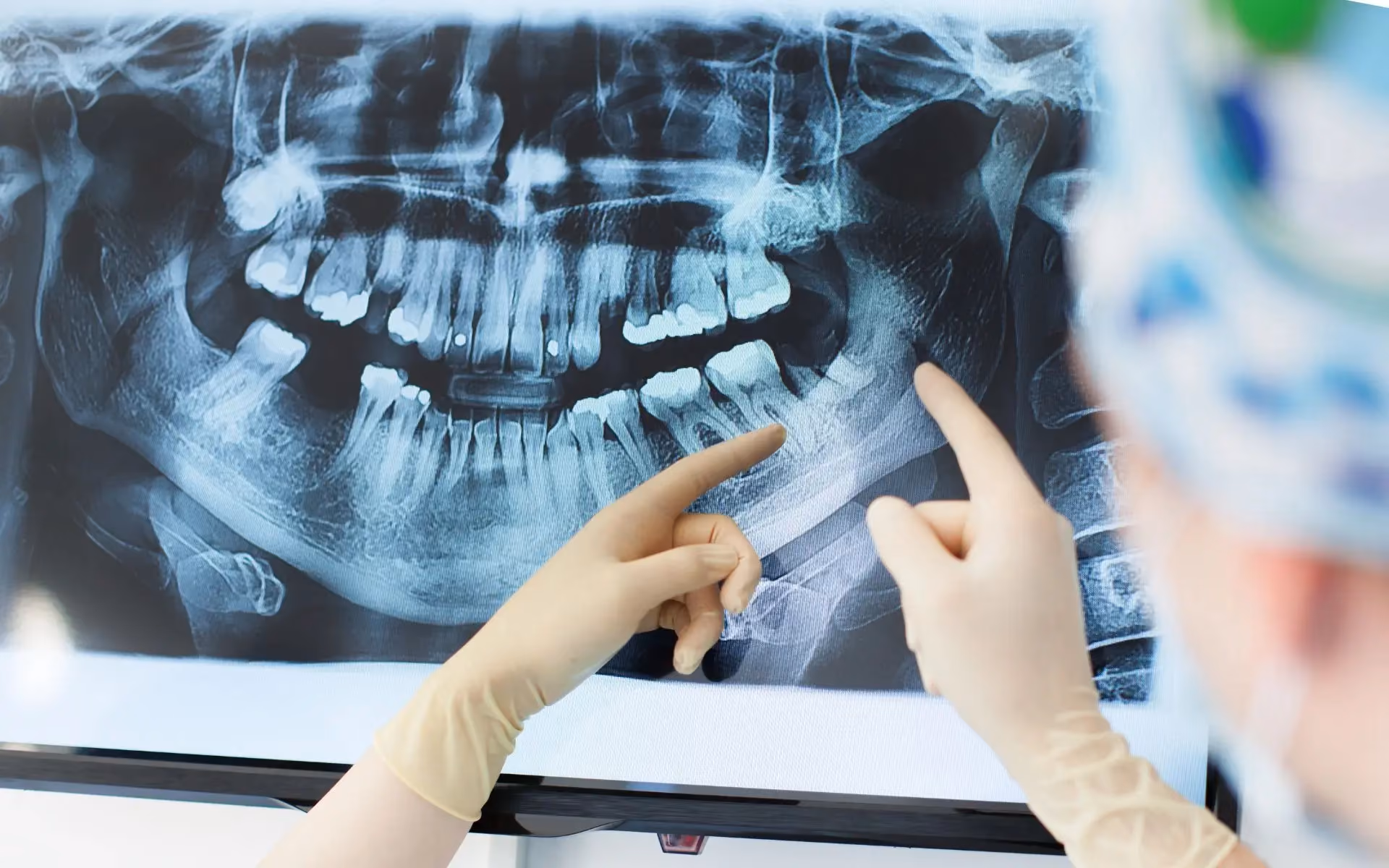 dentists looking at dental x-rays