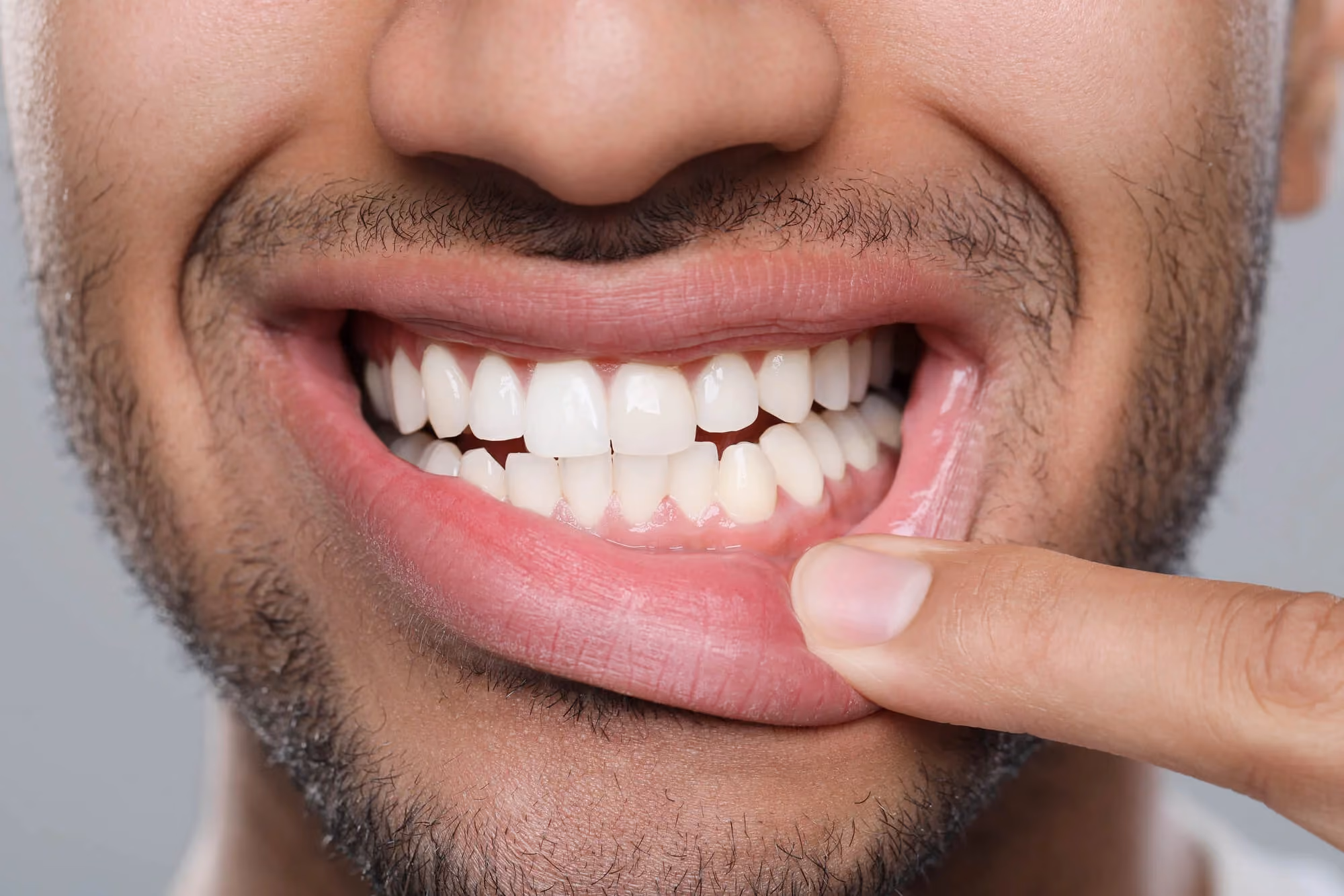 Man pointing at teeth gums