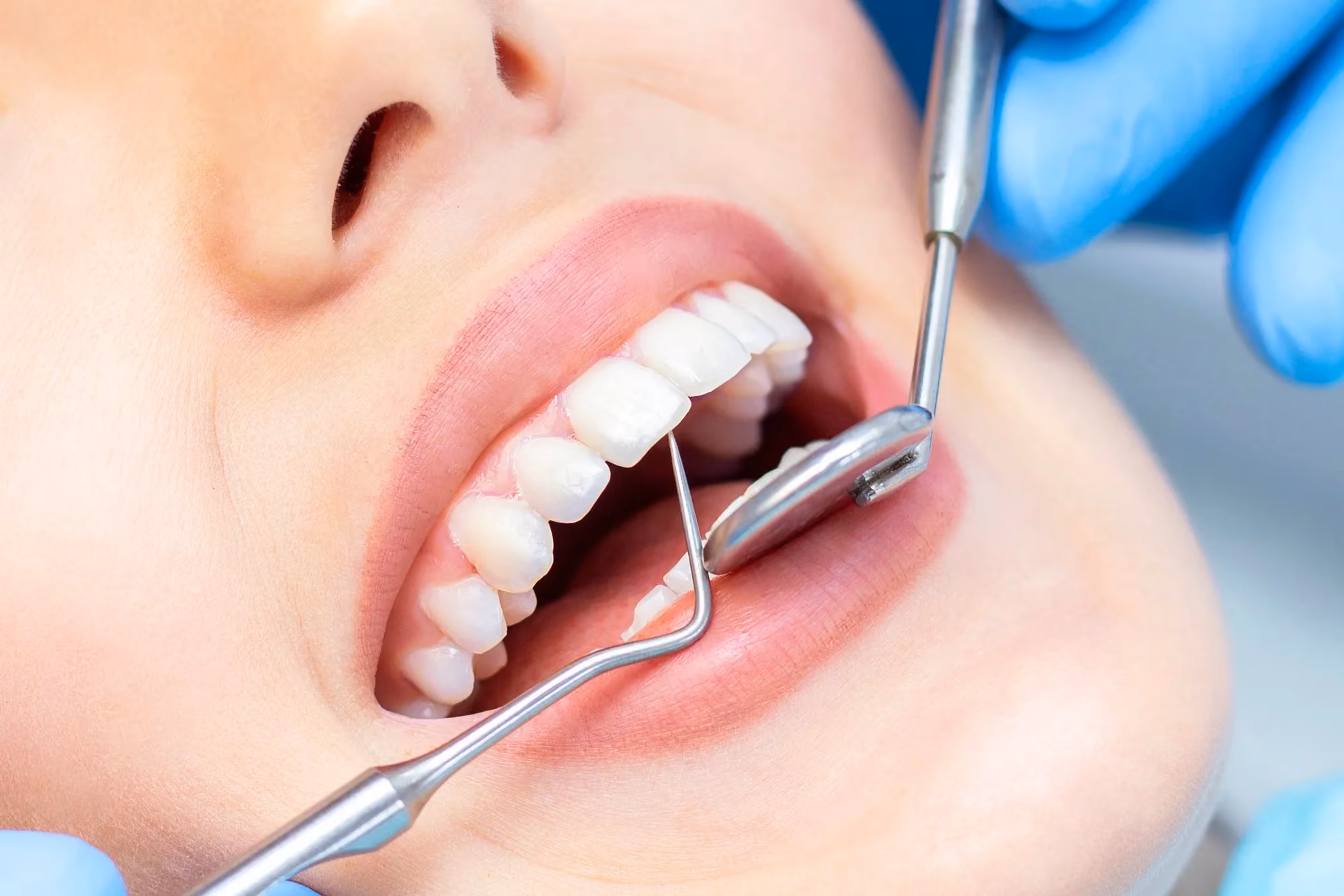 woman getting a dental exam