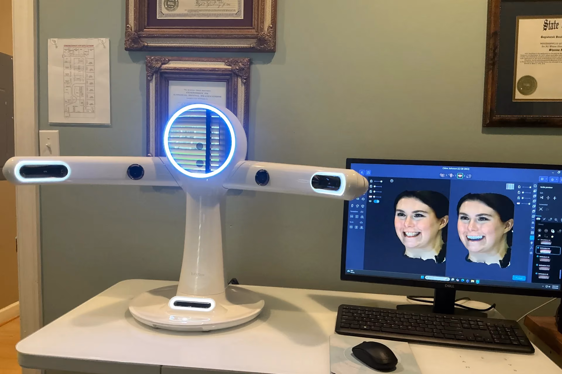 Digital smile imaging scanner