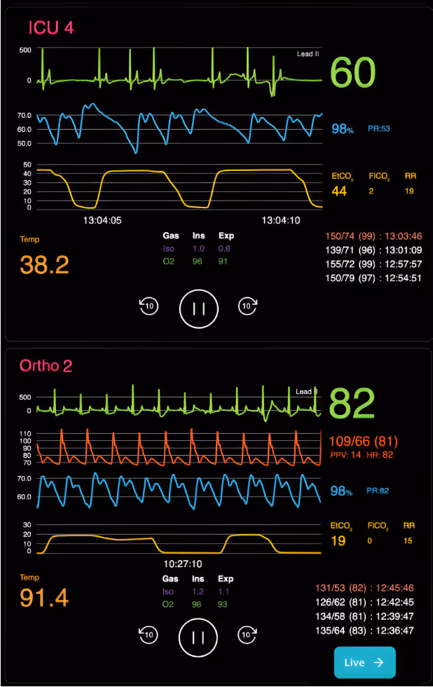 Medical monitor screen displaying vital signs for ICU 4 and Ortho 2, showing heart rate, oxygen saturation, respiratory rate, temperature, and blood pressure readings with waveform graphs.