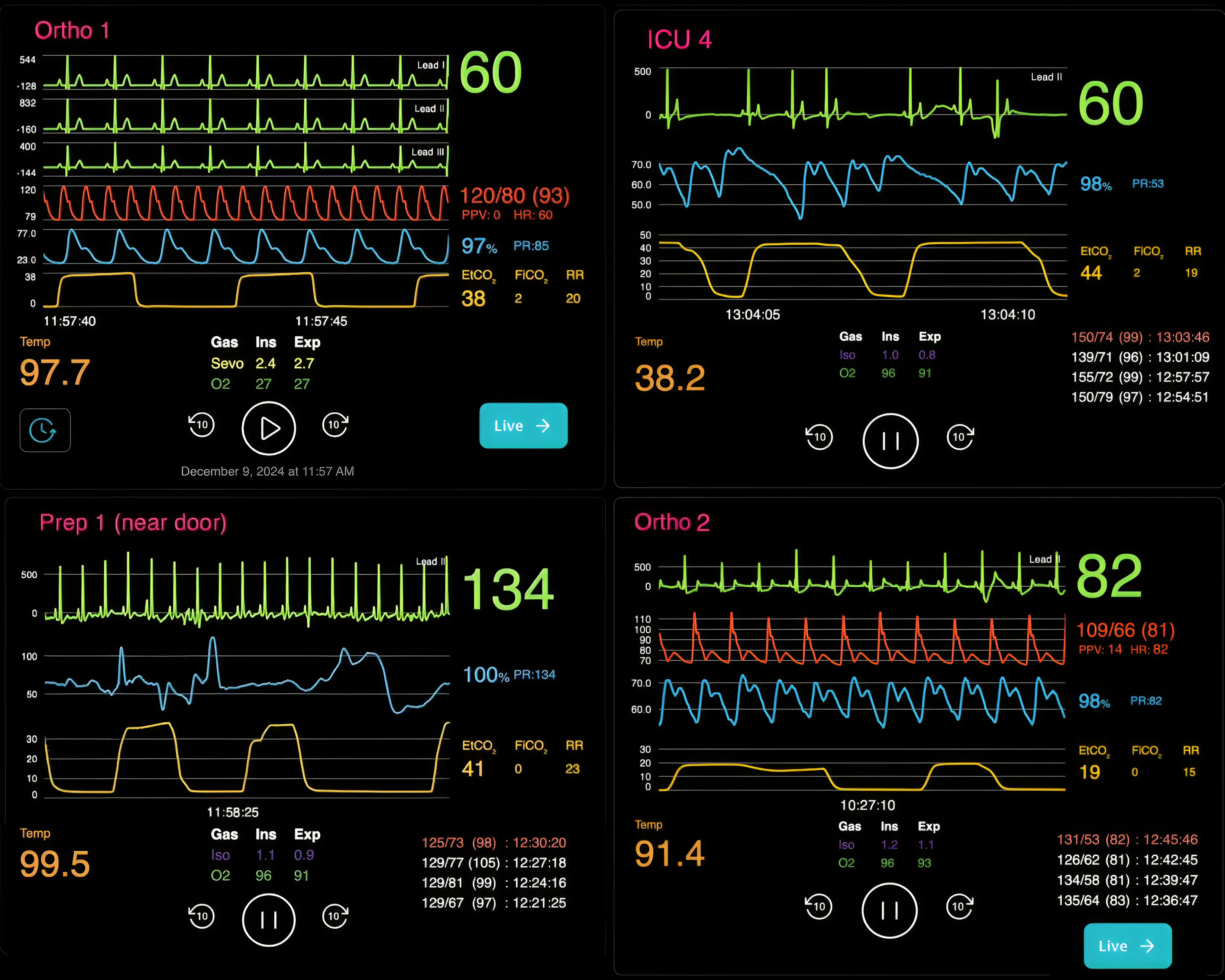 Four patient vital sign monitors showing heart rates, ECG waveforms, oxygen saturation, temperature, blood pressure, and respiratory parameters in medical settings.