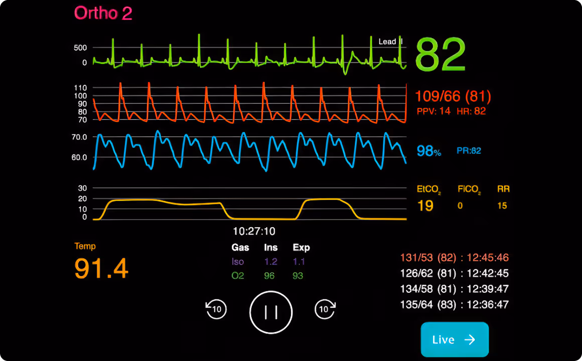 Medical monitor showing vital signs including heart rate 82, blood pressure 109/66, oxygen saturation 98%, temperature 91.4, and respiratory parameters over time.