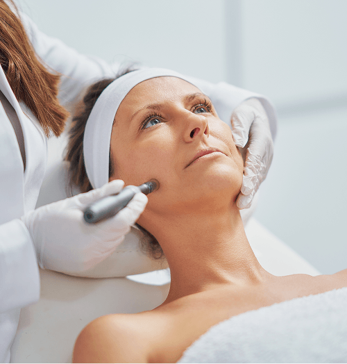 RF Microneedling