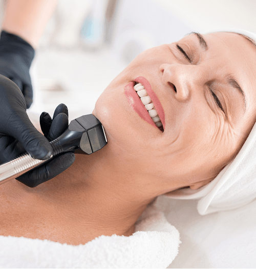 XERF™ Skin Tightening