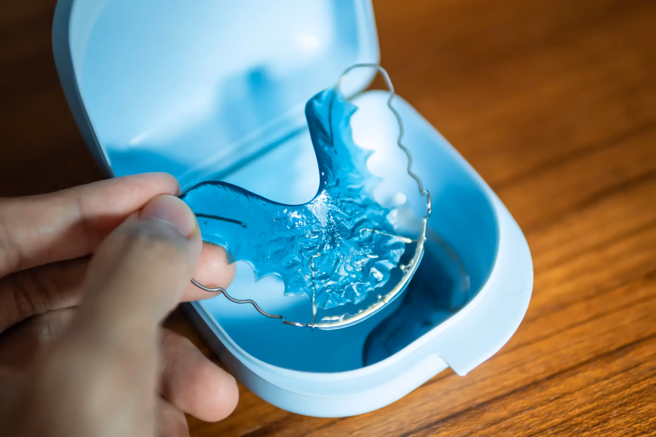 Retainer Repair