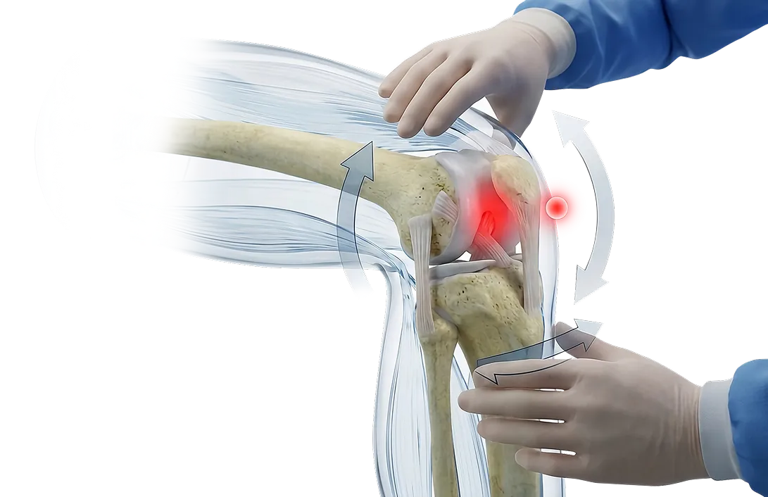 Medical illustration of a bent knee joint with highlighted pain area and directional arrows showing motion, held by gloved hands.