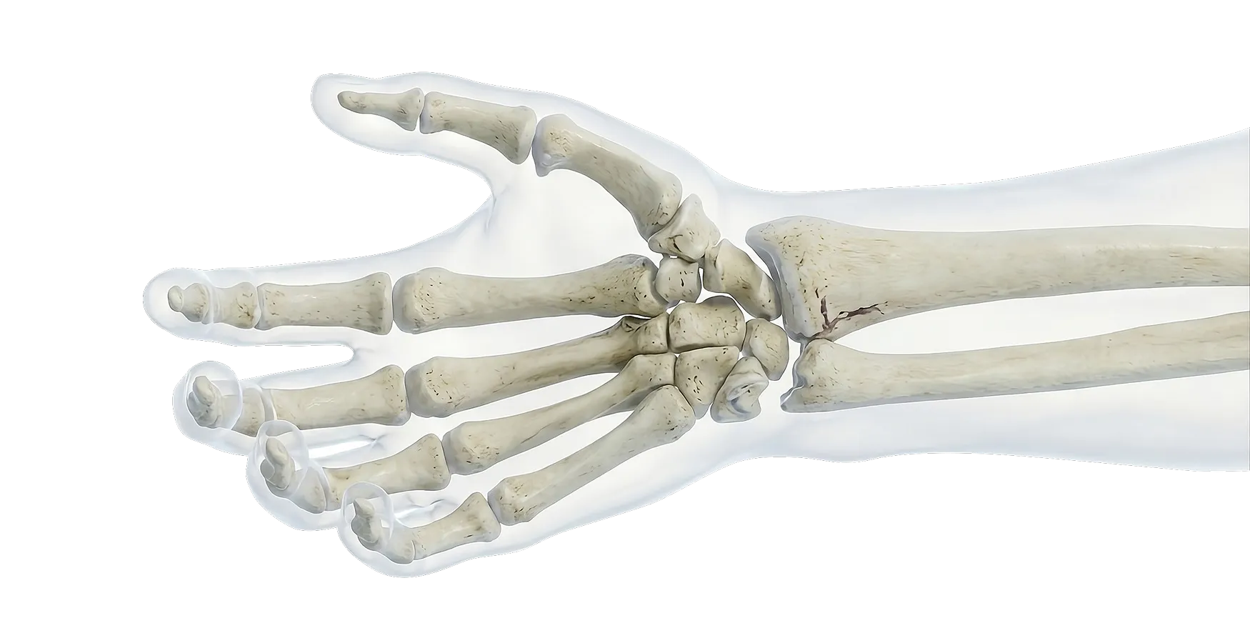 Close-up anatomical illustration of a human hand skeleton showing bones including phalanges, metacarpals, carpals, radius, and ulna.
