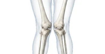 X-ray image of human knees showing femur, patella, tibia, and fibula bones.