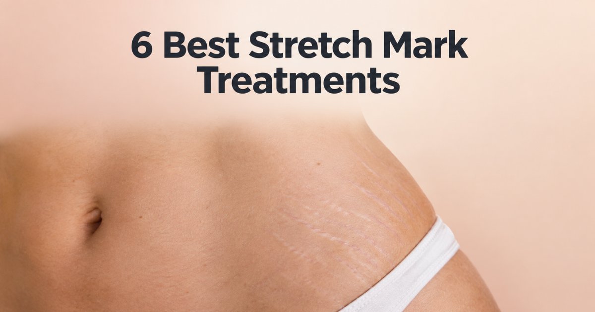 6 Best Stretch Mark Creams and Treatments, Ranked by Evidence