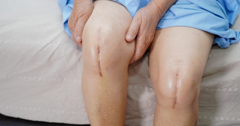 __wf_সংরক্ষিত _ উত্তরাধিকার