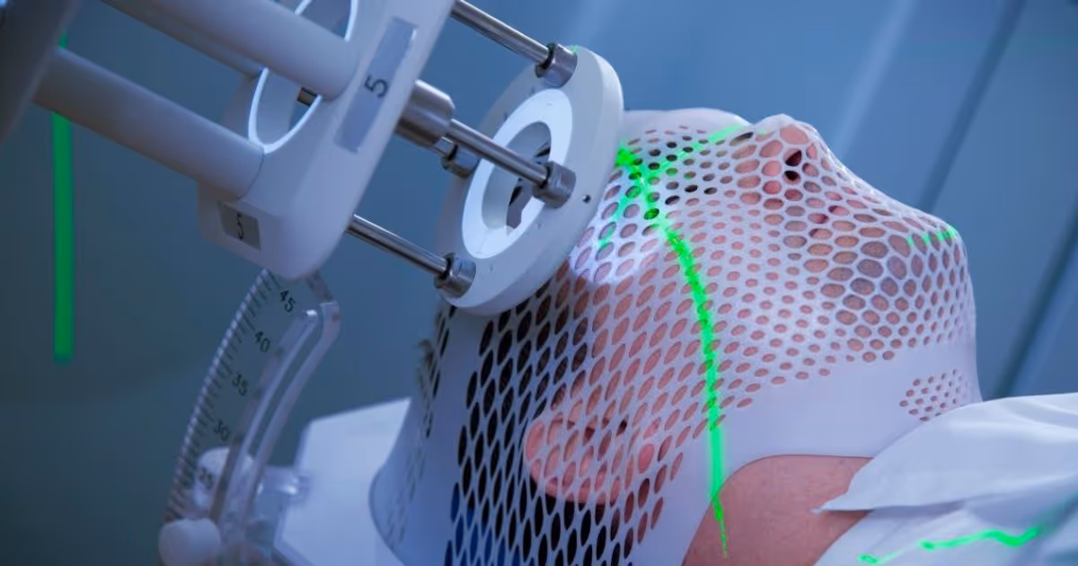 Patient undergoing radiation therapy with a head immobilization mask and laser alignment system