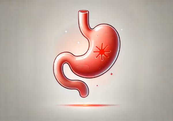 An inflamed stomach antrum showing signs of antral gastritis with redness indicating irritation