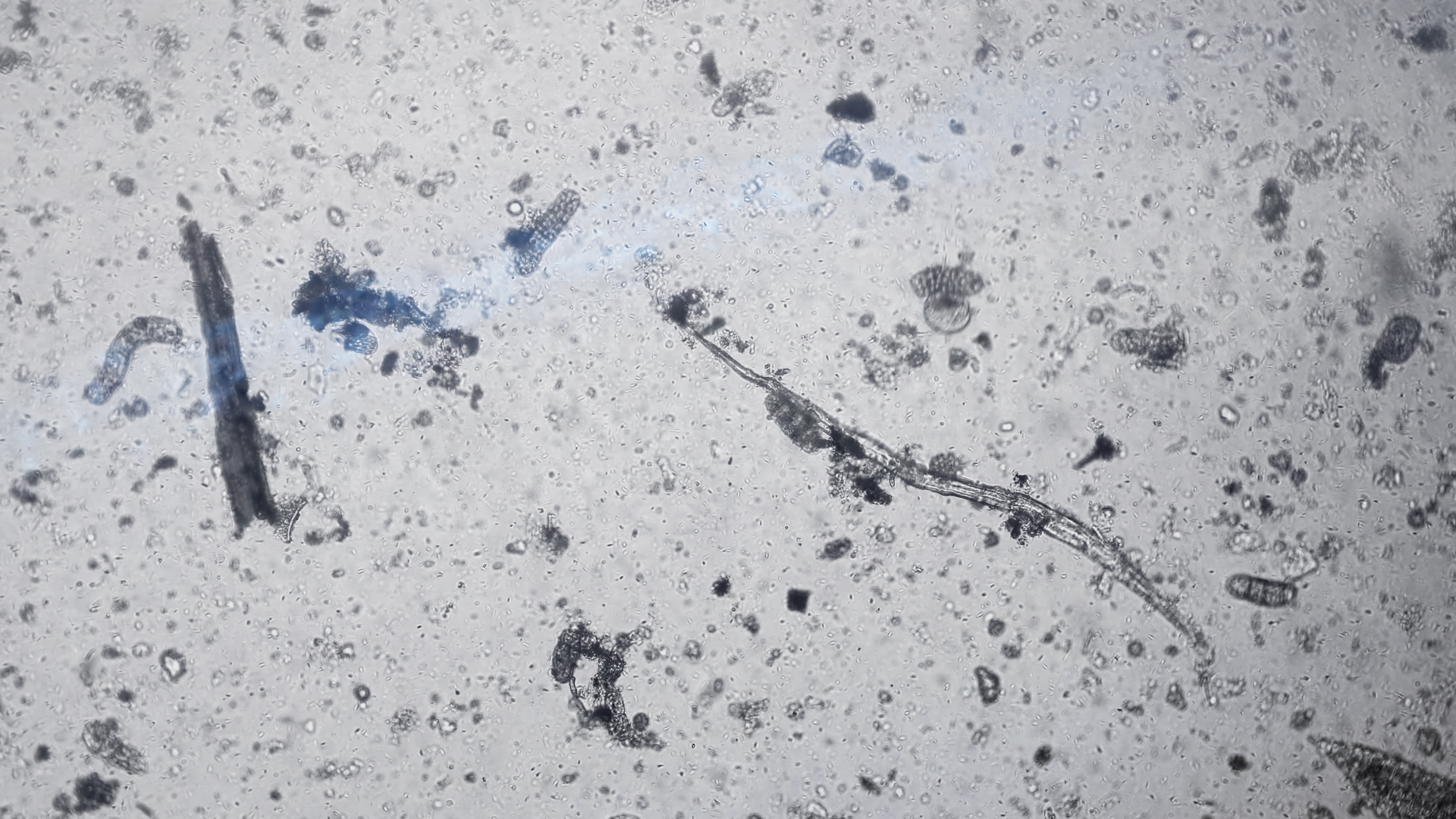 Addressing an Overlooked Risk: How Contaminated Ultrasound Probes Transmit STDs, and an Effective Solution for Prevention