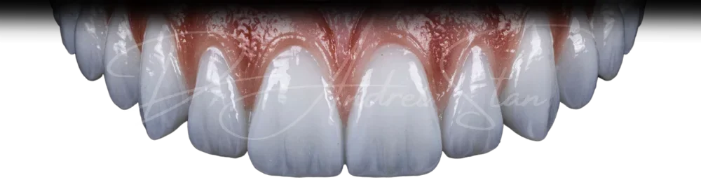 Lucrare-Definitiva-FP1-Concept-AO6AO8-5-e1737643116898