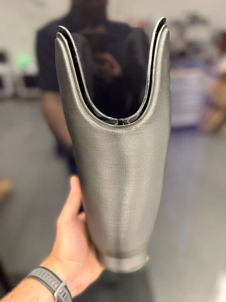 Definitive Prosthetic Socket